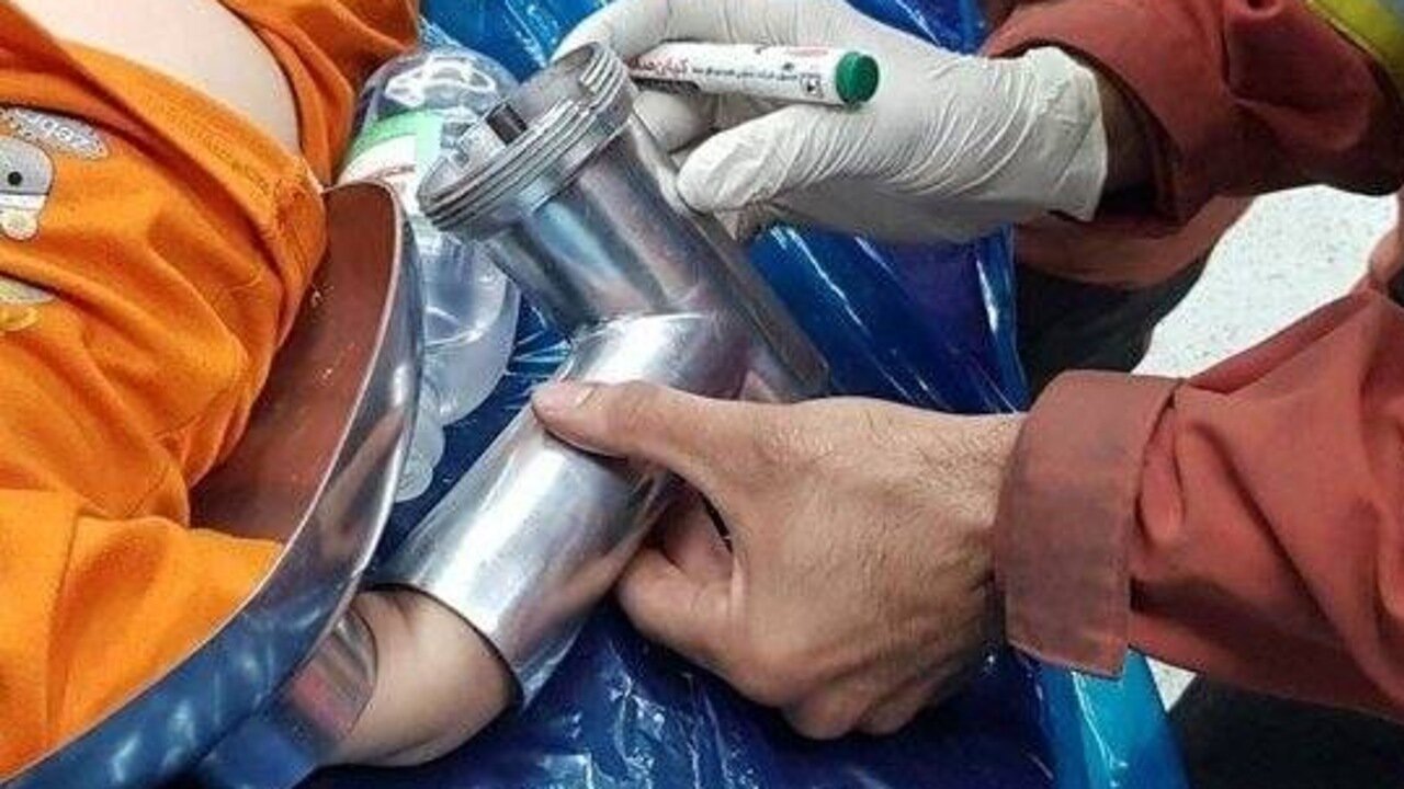 دست کودک دو ساله در چرخ‌گوشت گیر کرد؛ اقدام گروه نجات ویژه آتش‌نشانی برای رهاسازی